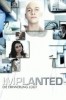Implanted - Die Erinnerung lügt